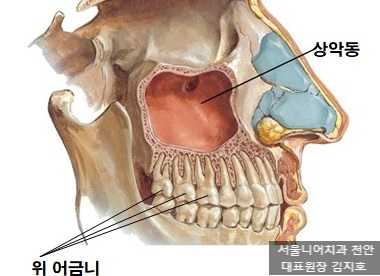 상악동과 위어금니